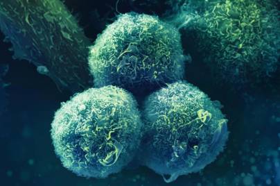 Oncology