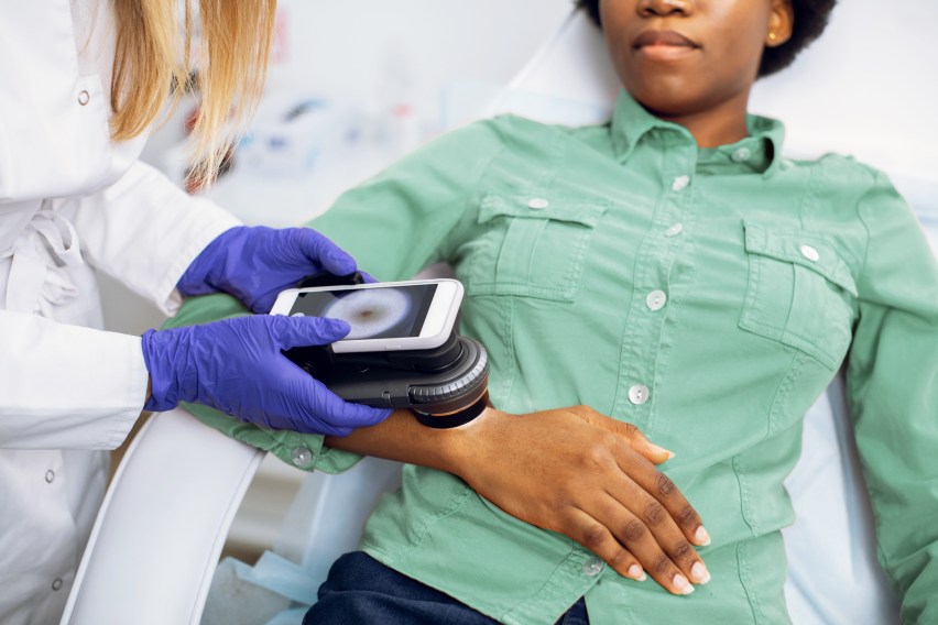 L’importance des examens de la peau : encourager les Canadiens à adopter l’approche Intime avec ta peau™
